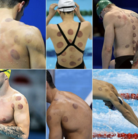 Chinese Cupping Set 6 Pcs with Hand Pump for Body Relief - No Flame Needed 4-pack solar