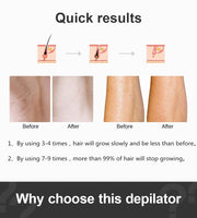 Ultrafast IPL Hair Removal Handset